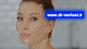 عوامل مؤثر بر ماندگاری لیفت نخ صورت