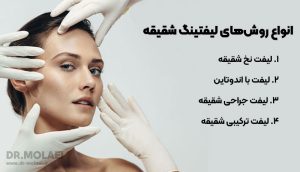 انواع روشهای لیفتینگ شقیقه