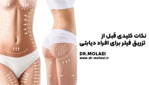 تزریق فیلر بادی برای افراد دیابتی