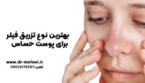 نوع تزریق فیلر برای پوست حساس