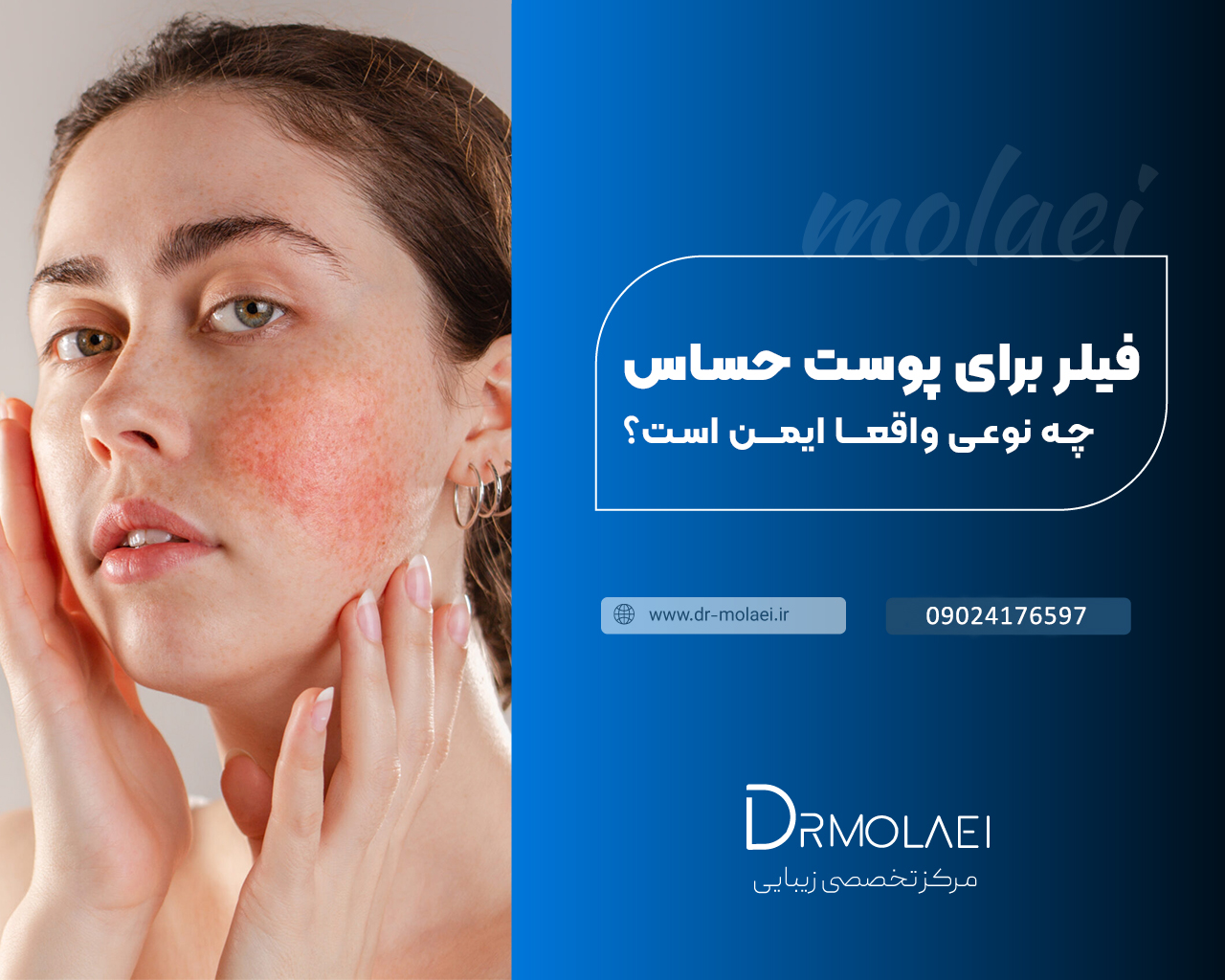 فیلر برای پوست حساس