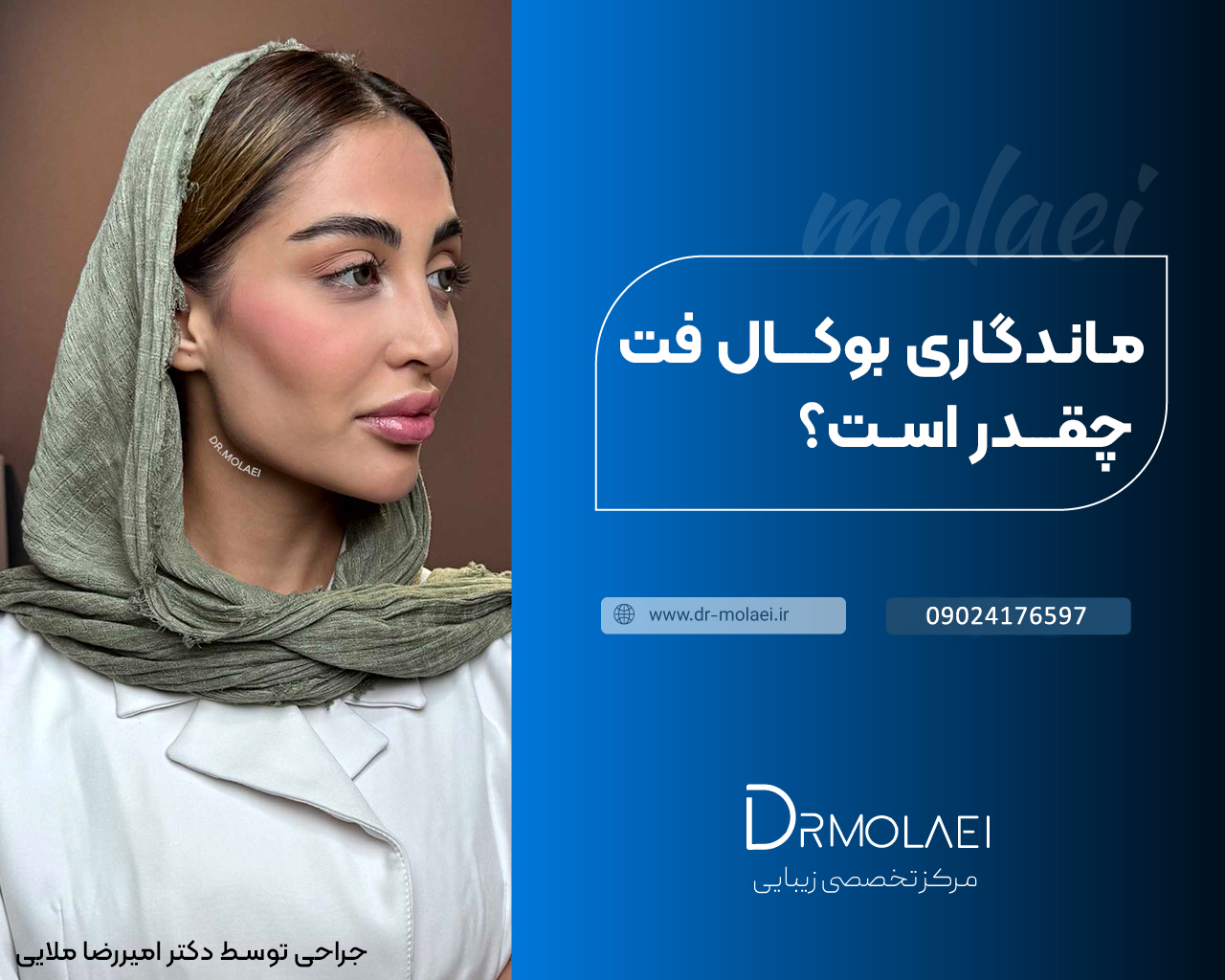 ماندگاری بوکال فت
