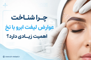 شناخت عوارض لیفت ابرو
