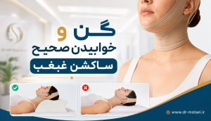 گن و خوابیدن صحیح بعد از ساکشن غبغب