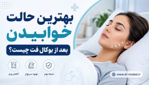 بهترین حالت خوابیدن بعد از بوکال فت