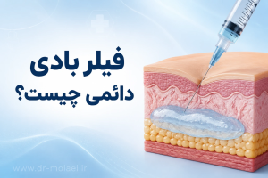 فیلر بادی دائمی