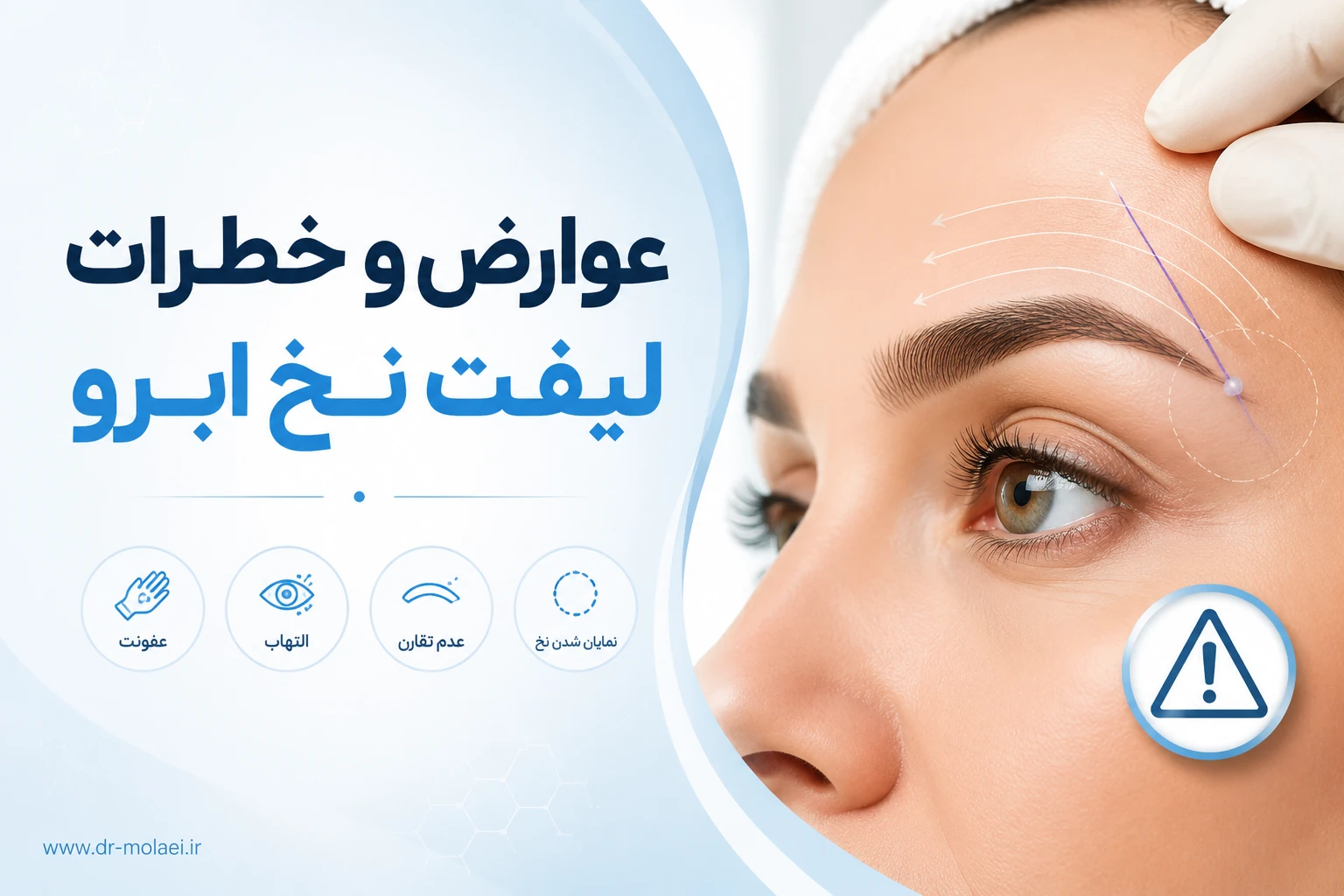 عوارض لیفت ابرو با نخ