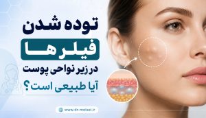 توده شدن فیلر ها در زیر نواحی پوست آیا طبیعی است؟