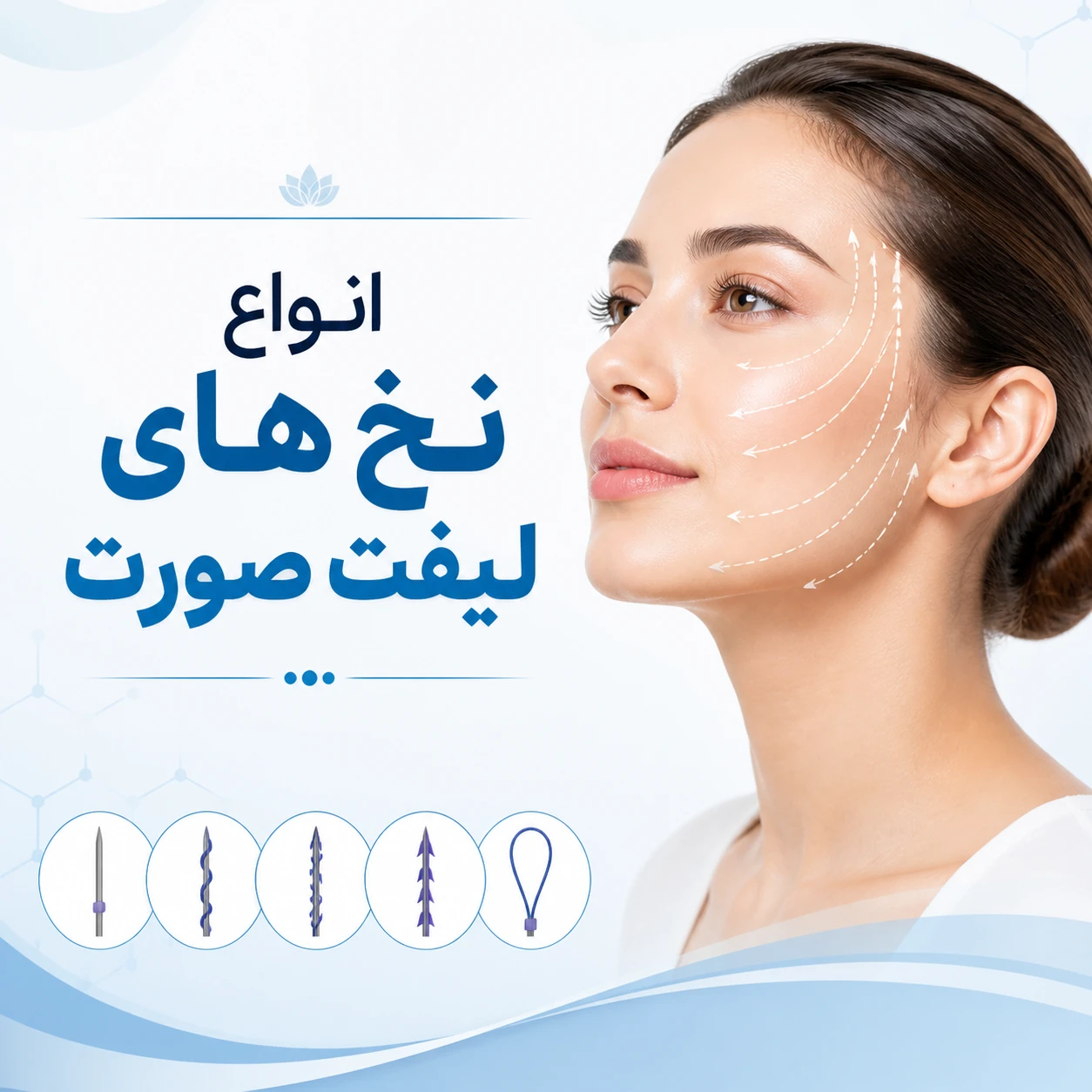 انواع نخ های لیفت صورت