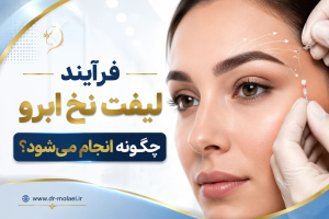 فرآیند لیفت نخ ابرو