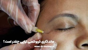 ماندگاری کربوکسی تراپی چقدر است؟