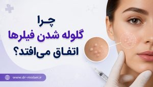 چرا گلوله شدن فیلرها اتفاق میافتد؟