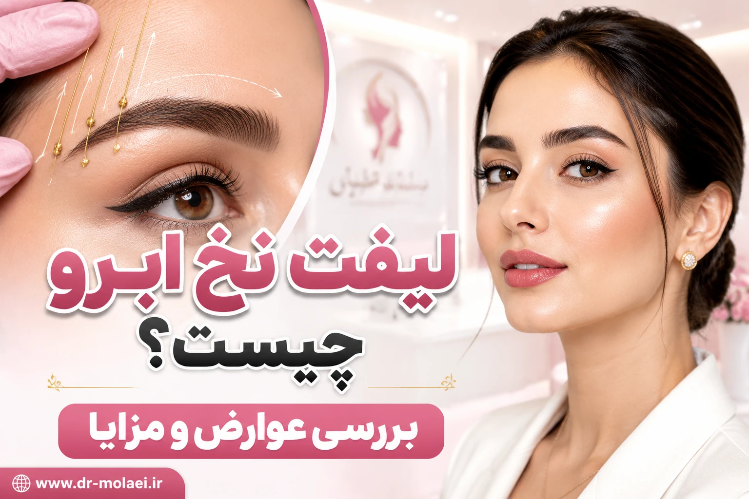 لیفت ابرو چیست