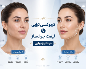 97eda103 564c 40d9 b113 95355d00f879 مقایسه کربوکسی تراپی با لیفت نخ