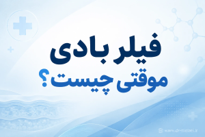 فیلر بادی موقتی