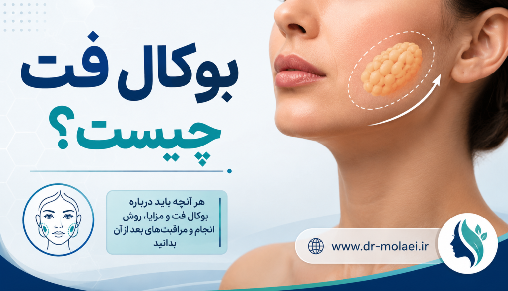 بوکال فت چیست؟