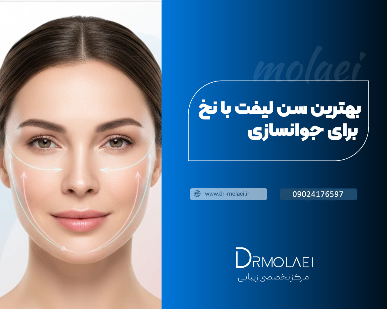 بهترین سن برای لیفت با نخ