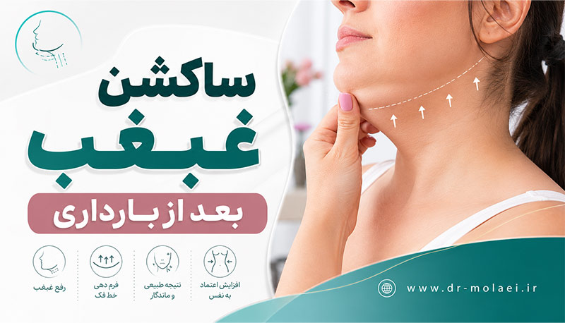 ساکشن غبغب بعد از بارداری