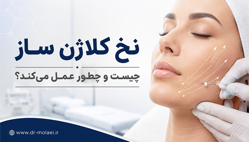 نخ لیفت محرک کلاژن در کدام نواحی استفاده میشود؟