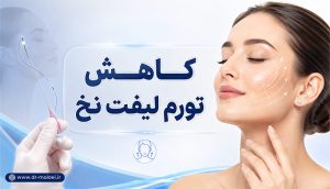 کاهش تورم لیفت نخ