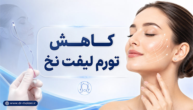 کاهش تورم لیفت نخ