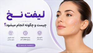 لیفت نخ چیست