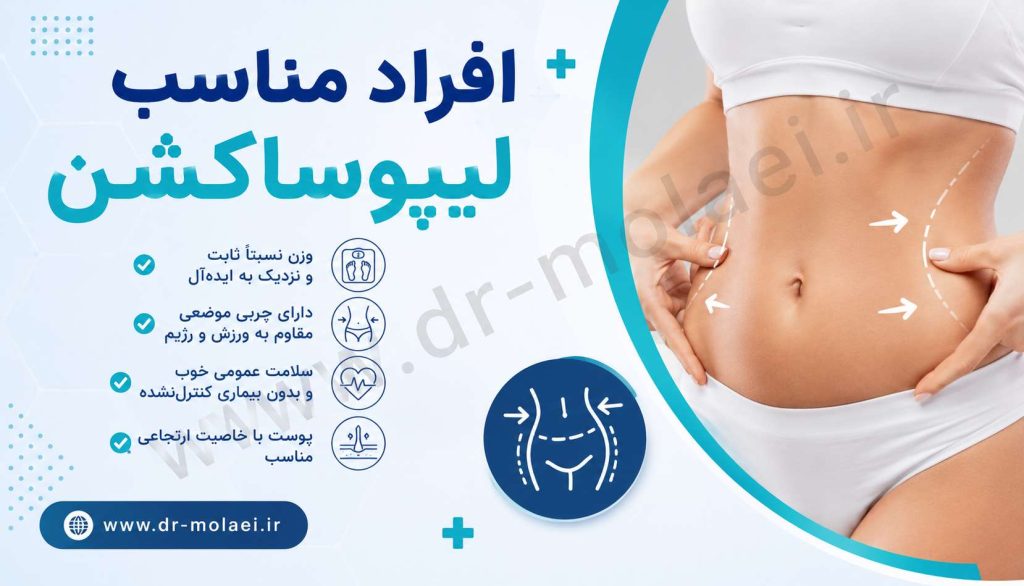 افراد مناسب لیپوساکشن