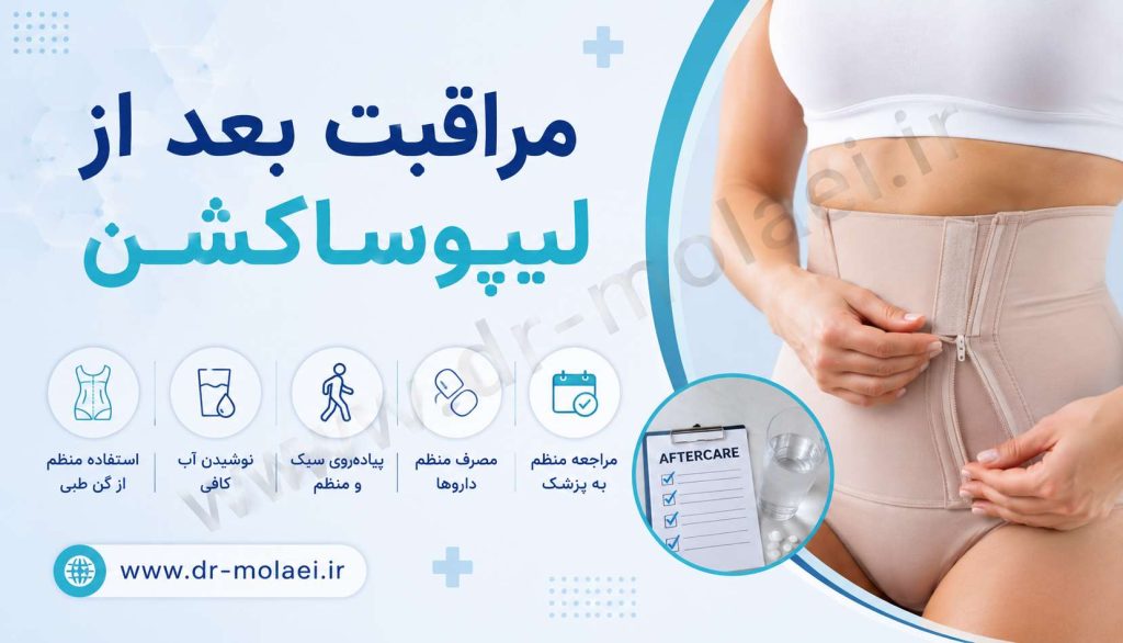 مراقبت بعد از لیپوساکشن