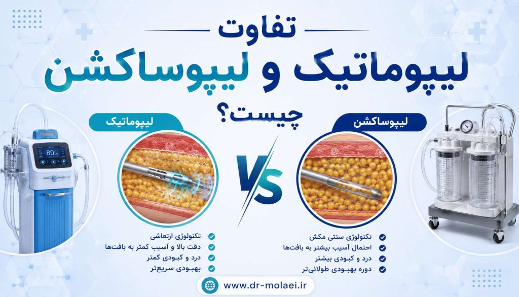 تفاوت لیپوماتیک و لیپوساکشن