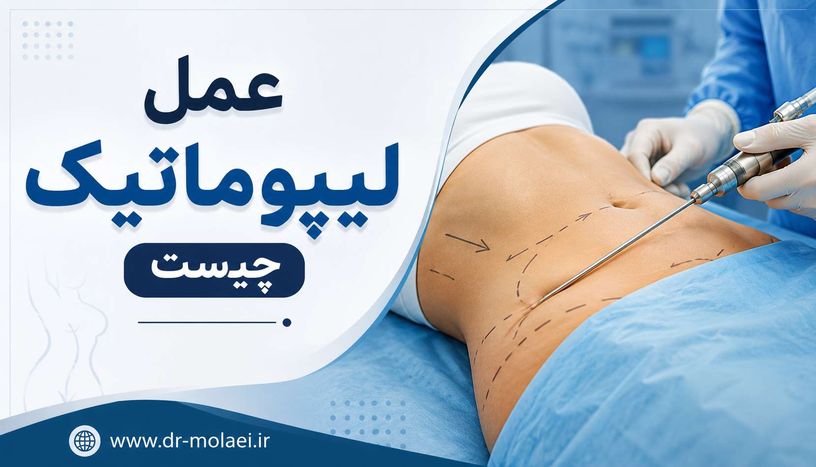 عمل لیپوماتیک چیست
