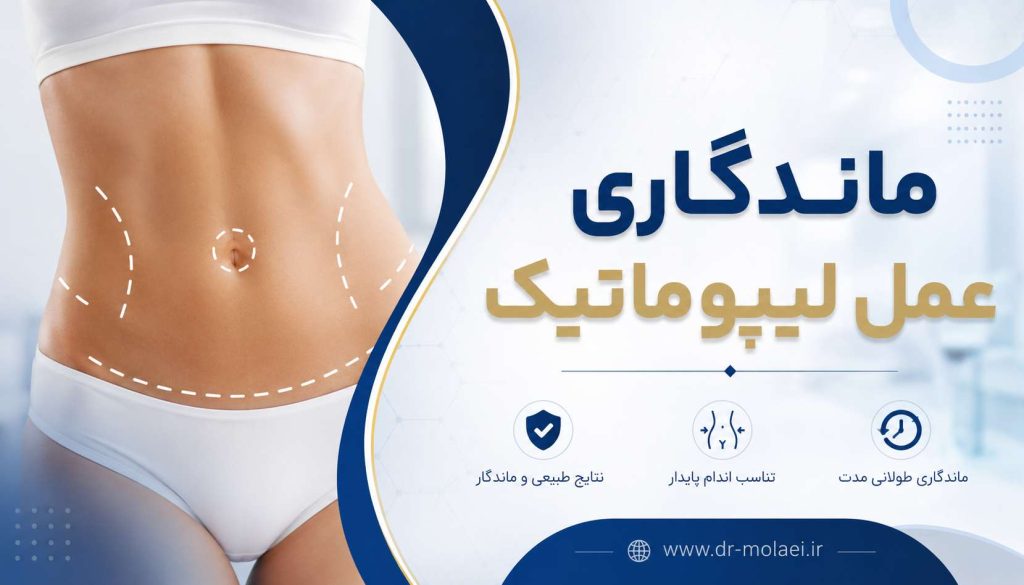 ماندگاری عمل لیپوماتیک