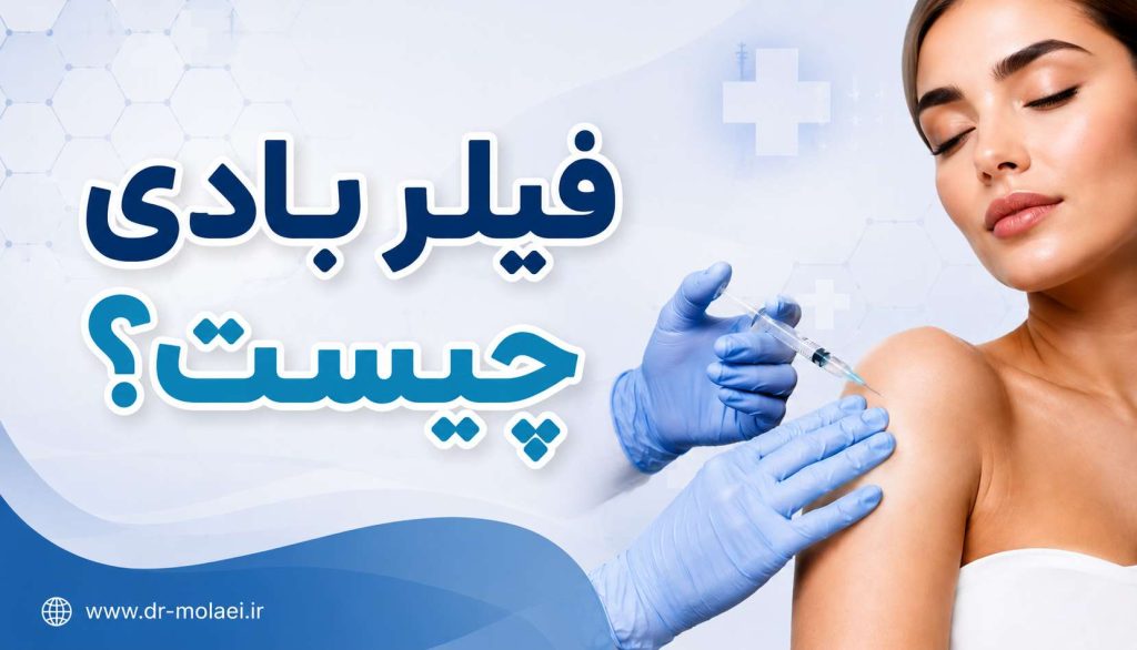 فیلر بادی چیست