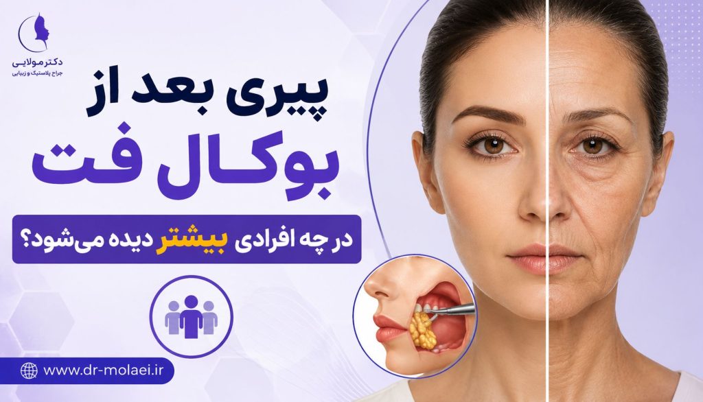 پیری بعد از بوکال فت در چه افرادی بیشتر دیده میشود؟