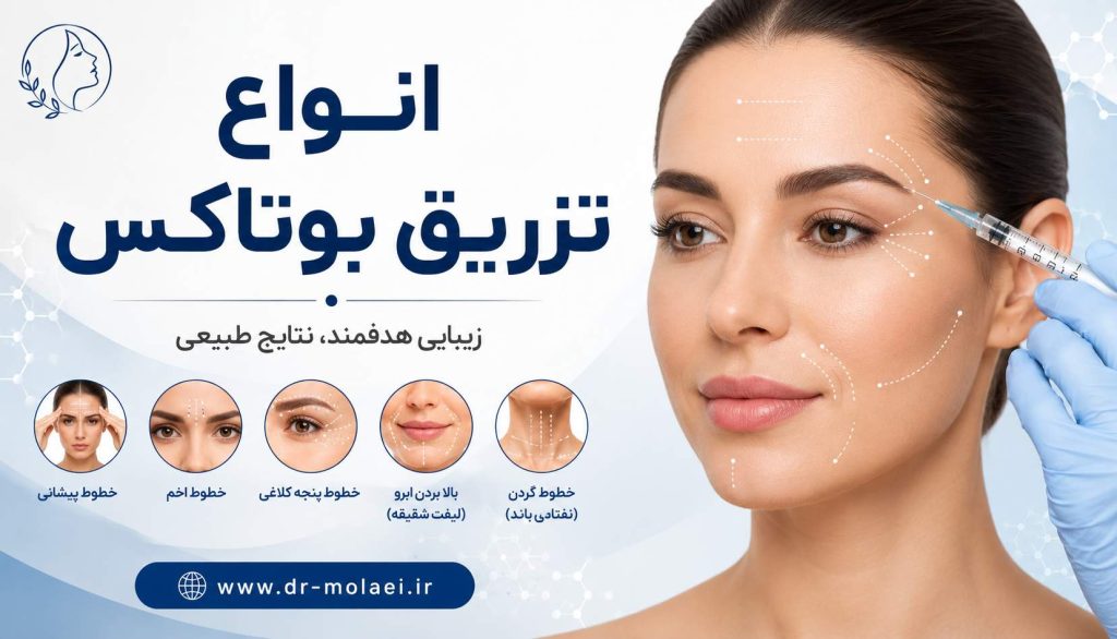 انواع تزریق بوتاکس